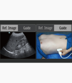 BeneHeart D60 - Point-of-care Ultrasound