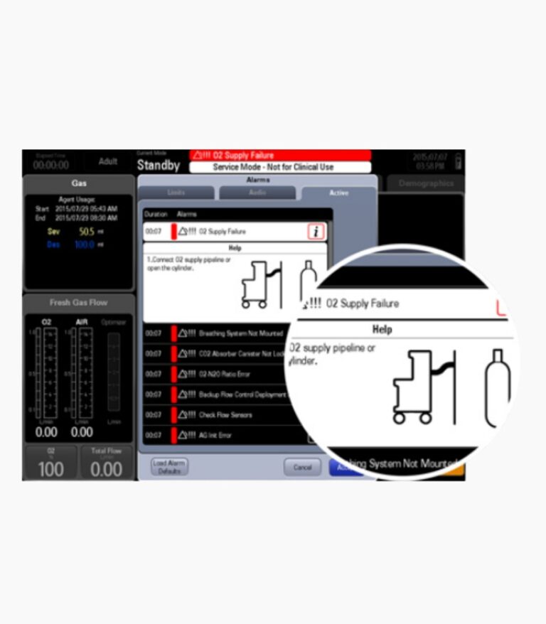 B&CS - Anesthesia System - Visual System Check and Smart Alarm